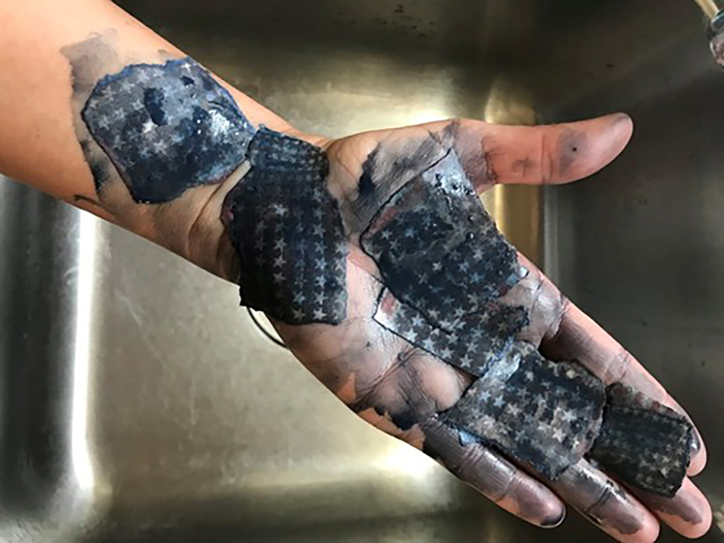 All You Need Is A Vision